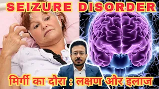 Seizure Disorder Treatment : मिर्गी का जड़ से इलाज । #epilepsy #seizures