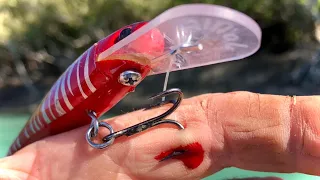 I HOOKED MYSELF! - How To Remove A Hook In Your Hand (Safest Way)