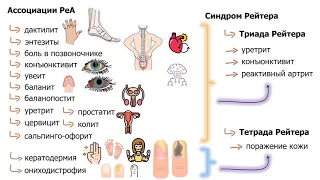 реактивные и инфекционные артриты