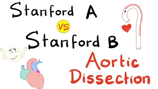 Stanford Type A vs Stanford Type B | Aortic Dissection