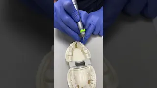 Implant Placement Demonstration First Part