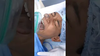 Nose Tumor Girl going under Anesthesia