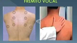 Semiología-Examen Físico normal de Tórax