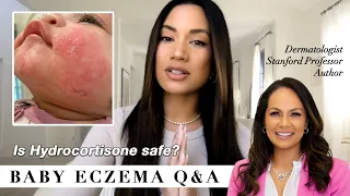 Baby Eczema Q&A, treatment & tips from a leading Dermatolgist!