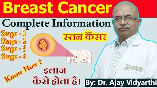 Breast Cancer - स्तन कैंसर | Stage 1 to Stage 4 - Complete Info & Detection | By: Dr. Ajay Vidyarthi