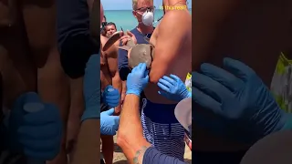 Shark latches on to man's arm! EMS struggles to remove it! #fishing #shorts #florida #beach