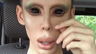 Man Undergoes 100 Procedures To Become A Genderless Alien