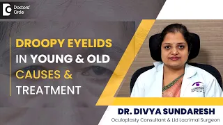 What causes a droopy eyelid| How to INSTANTLY lift Droopy eyelids-Dr.Divya Sundaresh|Doctors' Circle