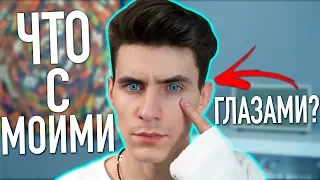 ЧТО СЛУЧИЛОСЬ С МОИМИ ГЛАЗАМИ?