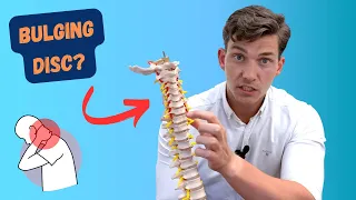 6 "Tell-Tale" Signs of a Bulging Disc in Neck