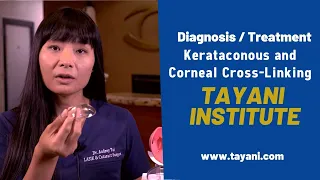 Kerataconus and Corneal Cross-Linking | Tayani Institute