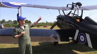 SE5a pilot chat