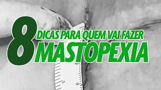 8 DICAS PARA QUEM VAI FAZER MASTOPEXIA I CIRURGIA PLÁSTICA