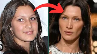 Bella Hadid's plastic surgery: the TRUTH | Opt into Beauty