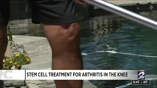 Stem cell treatment for arthritis in the knee