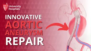 Endovascular Aneurysm Repair (EVAR)