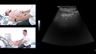 How to perform an ultrasound exam of the gastrointestinal (GI) tract.