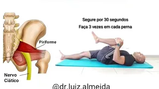 Síndrome do Piriforme- Exercícios para Dor no Nervo Ciático