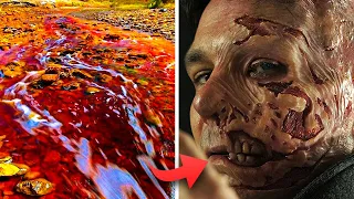 Top 10 Most Toxic And Deadly Substances In The World