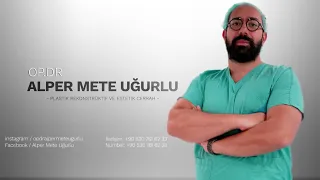 Karın Bölgesi Liposuction Yağ Aldırma Ameliyatı I BERFORE AND AFTER