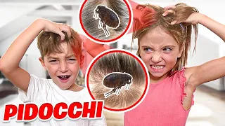 FIGLIACHIARA E FIGLIODIEGO HANNO PRESO I PIDOCCHI E DEVONO TAGLIARE TUTTI I CAPELLI!