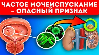 Если ходишь в туалет чаще ... раз! Проблемы почек, мочевого пузыря и даже...