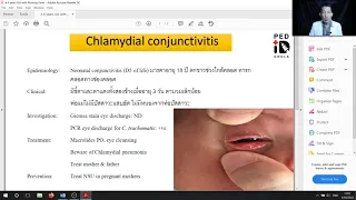 Mini lecture 25 Case demonstration Chlamydial conjunctivitis