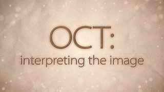 OCT: Interpreting the image