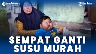 Kenzi Bayi Obesitas di Bekasi, 1,4 Tahun Berat Badan 27 Kilo, Doyan Ngemil Ciki