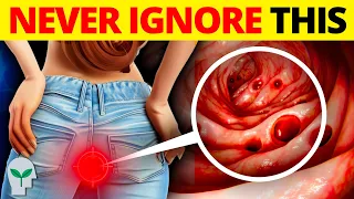 Top 10 Critical Colon Cancer Symptoms You Should Never Ignore