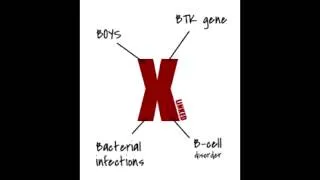 X-linked (Bruton's) Agammaglobulinemia - Defect, Presentation & Findings