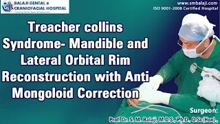 Treacher collins Syndrome-Mandible & Lateral Orbital Rim Reconstruction with Anti Mongoloid...