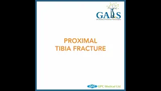Proximal Tibia Fracture - Case Discussion | GAITS Academy