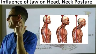 Why the Position of Jaw Influences Head, Neck & Body Posture by Dr Mike Mew