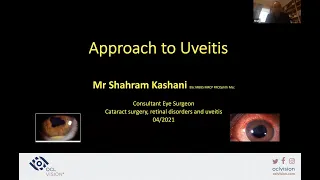 OCL Webinar - Uveitis