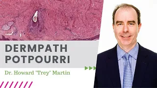 Dermpath Potpourri / May 2020  Dermpath Happy Hour