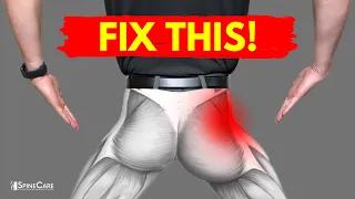 Best Hip Exercises for Instant Pain Relief (NO EQUIPMENT!)