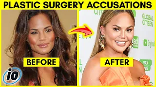 Top 10 Influencers Who Claim They Haven't Had Plastic Surgery