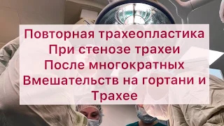 Рецидив стеноза трахеи через 10 лет после излечения: что делать?