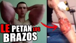 ¡¡ Le EXPLOTAN los BRAZOS !!💪💥 El CULTURISTA RUSO LOCO !!