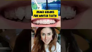 BEST BRACE COLORS FOR WHITER TEETH! #shorts