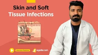 Skin and Soft Tissue Infections | Clinical Medicine | Video Lectures | Medical V-Learning