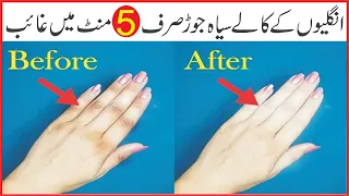 How to Get Red of Dark Knuckles And Get Brighten Hands & Feet In Urdu/Hindi