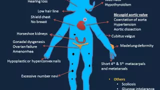 Genetic Disorders-III