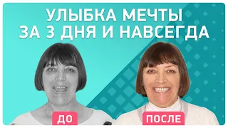 Имплантация зубов all-on-6® на верхней челюсти всего за 3 дня 👉 Отзыв пациентки Smile-at-Once