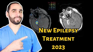 NEW Epilepsy Treatments in 2024 WITHOUT MEDICATIONS