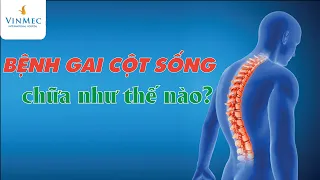 Điều trị gai cột sống như thế nào?