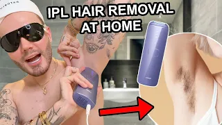 How to get Laser Hair Removal At Home! || 4 month update using Ulike