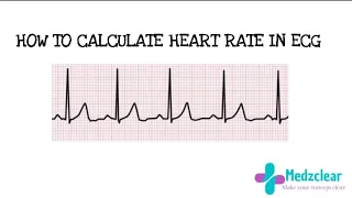 Easy way to calculate heart rate on ECG/EKG ( 6 second strip)