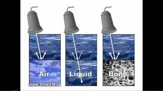 Ultrasound Basics